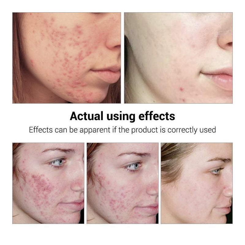 Soro de Arroz Branco para Limpeza Facial - Rorec