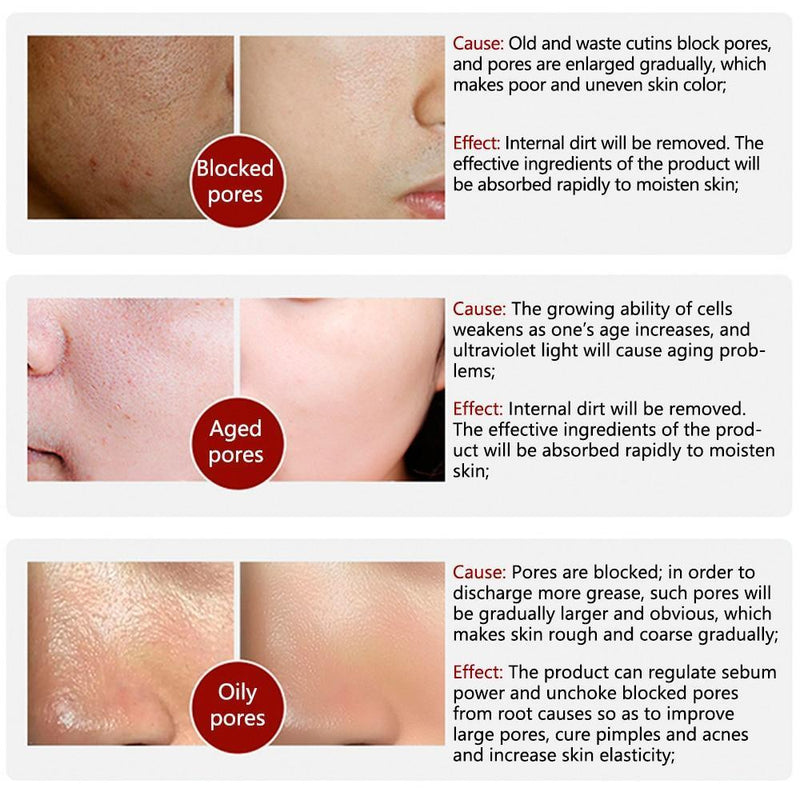 Soro de Arroz Branco para Limpeza Facial - Rorec